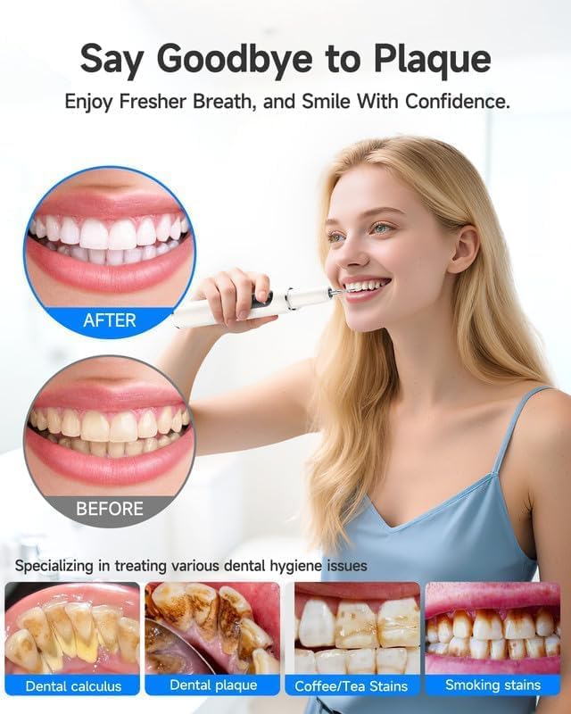 50% OFF🏆:  Professional Ultrasonic Dental Tool -Say Goodbye to Tartar at Home!🏡🦷