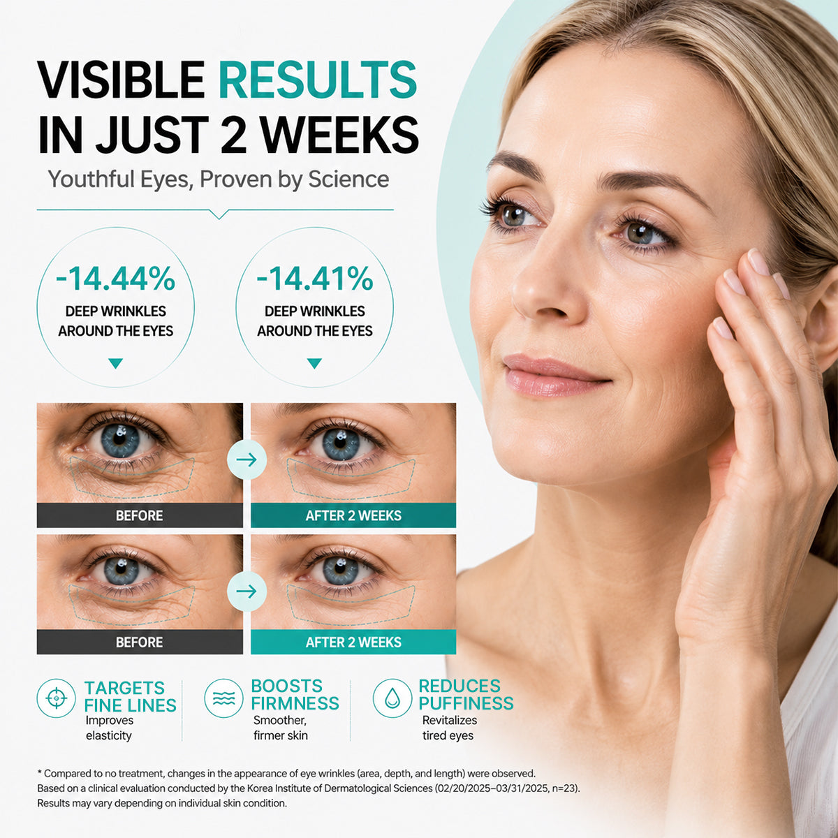 PDRN micro-vibration eye cream — source product image